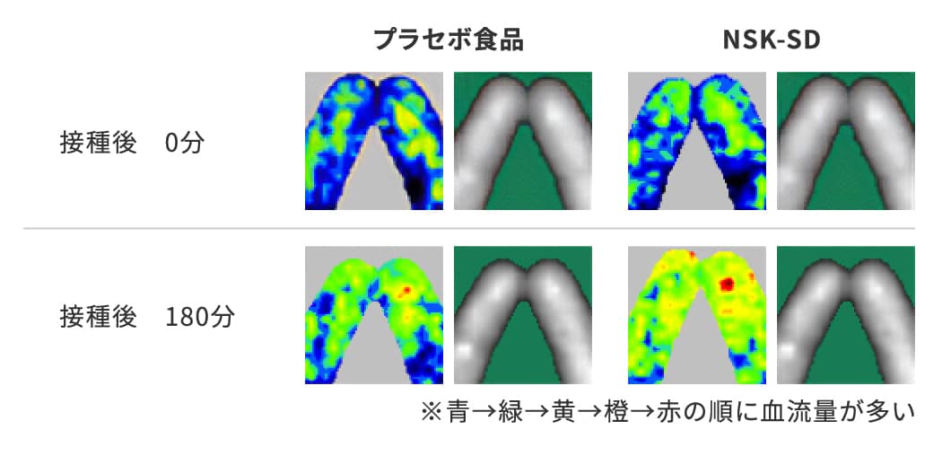 接種後 0分と接種後 180分のプラセボ食品とNSK-SDの比較※青→緑→黄→橙→赤の順に血流量が多い